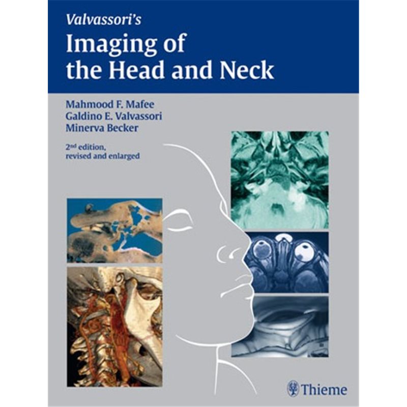 Imaging of the Head and Neck